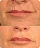 Nuskin Tru Face Line Corrector