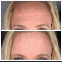 Nuskin Tru Face Line Corrector